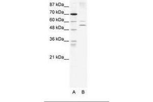 Image no. 1 for anti-Autoimmune Regulator (AIRE) (AA 76-125) antibody (ABIN203264) (AIRE antibody  (AA 76-125))