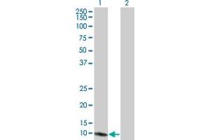 Western Blot analysis of SEPX1 expression in transfected 293T cell line by SEPX1 monoclonal antibody (M02), clone 8B2. (MSRB1 antibody  (AA 1-84))