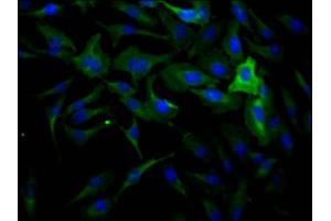 Immunofluorescence staining of Hela Cells with ABIN7127459 at 1:50, counter-stained with DAPI. (Recombinant DNM2 antibody)