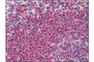 Immunohistochemistry (IHC) image for anti-BRCA1/BRCA2-Containing Complex, Subunit 3 (BRCC3) (AA 1-316), (N-Term) antibody (ABIN400864) (BRCC3 antibody  (N-Term))