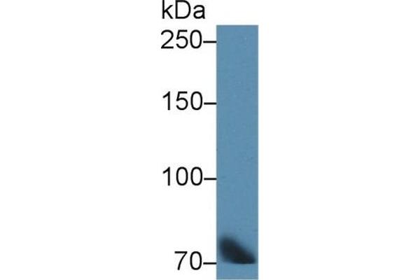 Transferrin antibody