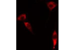 ABIN6274329 staining RAW264. (FOXC1 antibody)