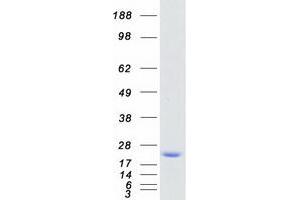 Validation with Western Blot (MYL2 Protein (Myc-DYKDDDDK Tag))