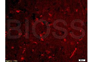Immunofluorescence (IF) image for anti-Lipocalin 2 (LCN2) (AA 101-198) antibody (ABIN685627)