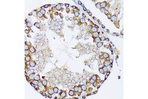 Immunohistochemistry of paraffin-embedded rat testis using γ-Tubulin Rabbit mAb (ABIN7271052) at dilution of 1:100 (40x lens). (TUBG1 antibody)