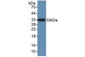 Western blot analysis of recombinant Human KLK10.