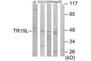 Western blot analysis of extracts from Jurkat cells, COLO205 cells, 293 cells and HepG2 cells, using TR19L antibody. (RELT antibody  (C-Term))