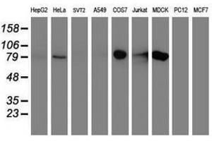 Image no. 2 for anti-Diacylglycerol Kinase, alpha 80kDa (DGKA) antibody (ABIN1497818) (DGKA antibody)