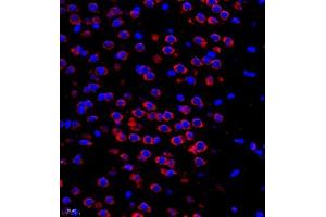 Immunofluorescent analysis of paraffin embedded mouse brain using Neurotensin (ABIN7074827) at dilution of 1: 500 (Neurotensin antibody)
