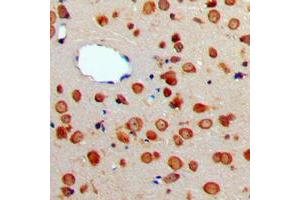 Immunohistochemical analysis of CD256 staining in human brain formalin fixed paraffin embedded tissue section.