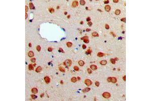 Immunohistochemical analysis of CD256 staining in human brain formalin fixed paraffin embedded tissue section. (TNFSF13 antibody  (Center))