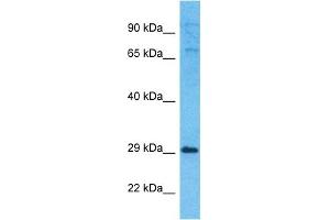 Host:  Rabbit  Target Name:  EXOS5  Sample Type:  721_B Whole Cell lysates  Antibody Dilution:  1. (EXOSC5 antibody  (N-Term))