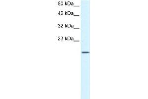 WB Suggested Anti-ZNF7 Antibody Titration:  1.
