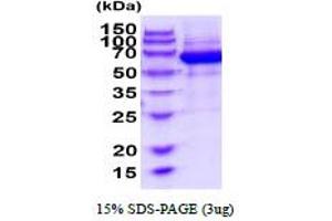 SDS-PAGE (SDS) image for EPH Receptor B4 (EPHB4) (AA 16-539) protein (His tag) (ABIN6387865) (EPH Receptor B4 Protein (EPHB4) (AA 16-539) (His tag))