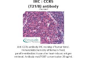 Image no. 1 for anti-Chemokine (C-C Motif) Receptor 5 (CCR5) antibody (ABIN1724086) (CCR5 antibody)