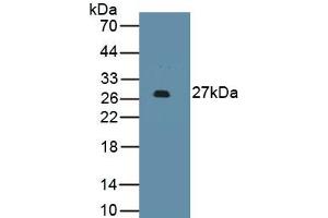 Detection of Recombinant PDCD1LG2, Human using Monoclonal Antibody to Programmed Cell Death Protein 1 Ligand 2 (PDL2) (PDCD1LG2 antibody  (AA 33-236))