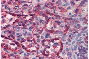 Human Spleen (formalin-fixed, paraffin-embedded) stained with CYCS antibody ABIN462359 followed by biotinylated anti-mouse IgG secondary antibody ABIN481714, alkaline phosphatase-streptavidin and chromogen. (Cytochrome C antibody)