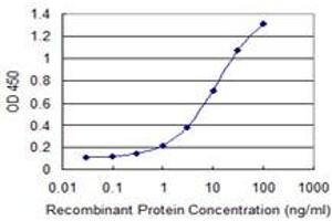 Detection limit for recombinant GST tagged GNL3 is 0. (Nucleostemin antibody  (AA 328-427))