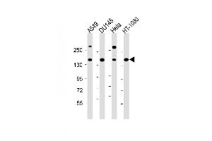 All lanes : Anti-COL4A1 Antibody (N-term) at 1:1000 dilution Lane 1: A549 whole cell lysate Lane 2: D whole cell lysate Lane 3: Hela whole cell lysate Lane 4: HT-1080 whole cell lysate Lysates/proteins at 20 μg per lane.