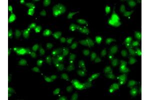 Immunofluorescence analysis of HeLa cell using CLK1 antibody. (CLK1 antibody)