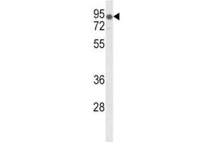 Western blot analysis of LDLR antibody and mouse lung tissue lysate. (LDLR antibody  (AA 391-419))