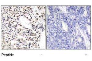 Image no. 1 for anti-Nuclear Factor-kB p65 (NFkBP65) (Ser529) antibody (ABIN197442)
