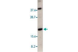 Western blot analysis of 50 ug of total cell lysate from HeLa cells with CRADD polyclonal antibody  at 1 : 500 dilution. (CRADD antibody  (AA 181-199))