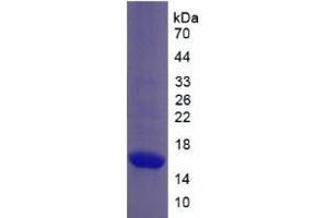 SDS-PAGE analysis of Monkey Collagen Type X Protein. (COL10 Protein)