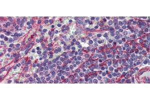 Rabbit Anti-MCTP1 Antibody  arp44441 Paraffin Embedded Tissue: Human Spleen Antibody Concentration: 5 ug/ml (MCTP1 antibody  (Middle Region))