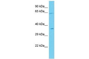 Host: Rabbit Target Name: ANKRD55 Sample Type: Jurkat Whole Cell lysates Antibody Dilution: 1. (ANKRD55 antibody  (C-Term))
