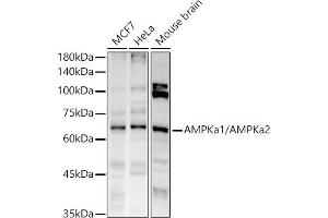 Western blot analysis of extracts of various cell lines, using AMPKa1/AMPKa2 antibody (ABIN6129902, ABIN6136848, ABIN6136849 and ABIN7101410) at 1:1000 dilution. (AMPK alpha antibody)