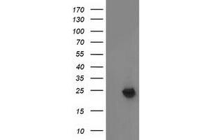 Western Blotting (WB) image for anti-Methylmalonic Aciduria (Cobalamin Deficiency) CblB Type (MMAB) antibody (ABIN1499509)