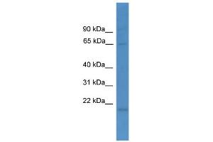 WB Suggested Anti-LTA4H Antibody Titration: 0. (LTA4H antibody  (N-Term))