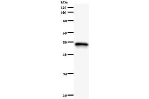 Western Blotting (WB) image for anti-Homeobox B5 (HOXB5) antibody (ABIN931146)