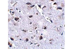 Immunohistochemical staining of mouse brain tissue with 2. (RCAN2 antibody  (Internal Region))