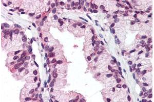 Human Prostate (formalin-fixed, paraffin-embedded) stained with DDX3X antibody ABIN337076 at 5 ug/ml followed by biotinylated goat anti-rabbit IgG secondary antibody ABIN481713, alkaline phosphatase-streptavidin and chromogen. (DDX3X antibody  (N-Term))