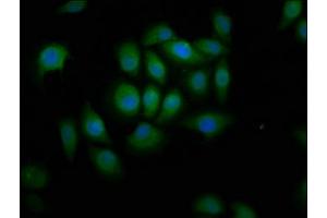 Immunofluorescence staining of A549 cells with ABIN7144872 at 1:166, counter-stained with DAPI. (ABCA12 antibody  (AA 45-158))