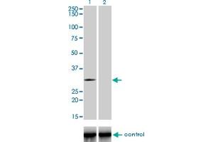 Western blot analysis of TLX3 over-expressed 293 cell line, cotransfected with TLX3 Validated Chimera RNAi (Lane 2) or non-transfected control (Lane 1). (TLX3 antibody  (AA 192-291))