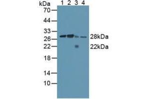 Figure. (Calpain S1 antibody  (AA 1-268))