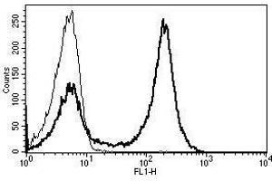 A typical staining pattern with the B-B8 monoclonal antibody of lymphocytes (CD5 antibody)