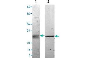 Lane 1: non-reducing conditions Lane 2: reducing conditions (EBI3 Protein)