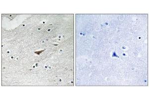 Immunohistochemistry analysis of paraffin-embedded human brain tissue using VE-Cadherin (Phospho-Tyr731) antibody. (Cadherin 5 antibody  (pTyr731))