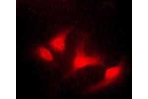 Immunofluorescent analysis of ABL1 staining in K562 cells. (ABL1 antibody  (C-Term))