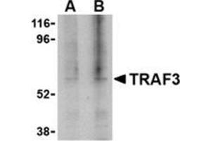 Western blot analysis of TRAF3 in 3T3 cell lysate with this product at (A) 1, and (B) 2 μg/ml. (TRAF3 antibody  (C-Term))