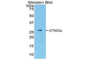 Detection of Recombinant PK, Mouse using Polyclonal Antibody to Pyruvate kinase isozymes R/L (PKLR) (PKLR antibody  (AA 114-323))