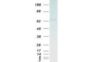 Validation with Western Blot