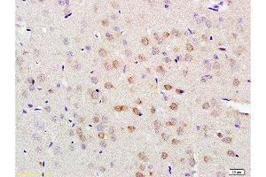 Formalin-fixed and paraffin embedded rat brain tissue labeled with Anti-LLGL1/2 Polyclonal Antibody, Unconjugated  at 1:200 followed by conjugation to the secondary antibody and DAB staining (LLGL1 antibody  (AA 801-900))
