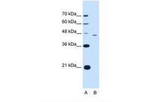 Image no. 1 for anti-Flap Structure-Specific Endonuclease 1 (FEN1) (AA 301-350) antibody (ABIN321044) (FEN1 antibody  (AA 301-350))