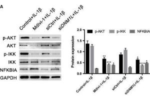 DNM1L deficiency attenuates the IL-1β-induced NF-κB activation in FLSs. (GAPDH antibody)