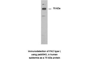 Image no. 1 for anti-Peptidyl Arginine Deiminase, Type I (PADI1) antibody (ABIN346990) (PADI1 antibody)